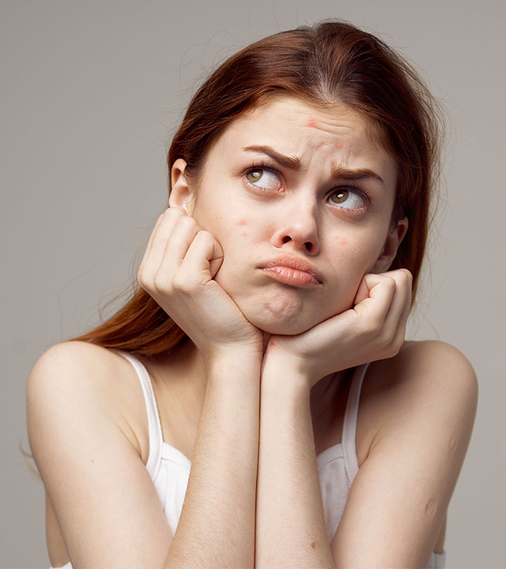 Acne And Pimple Treatment